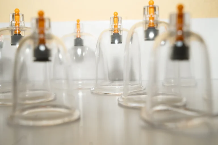 Nahaufnahme von mehreren transparenten Schröpfgläsern aus Glas mit gelben Ventilen.